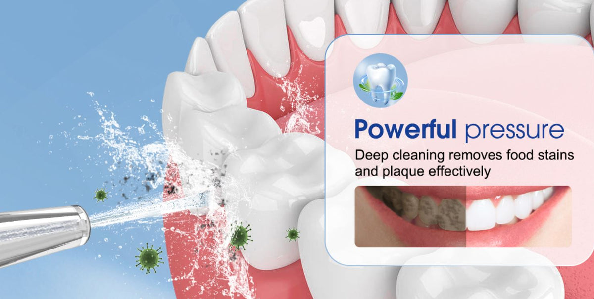 portable Cordless Water Dental Flosser- oral Irrigator Orthodentic teeth cleaner –  | Zinggal Qatar